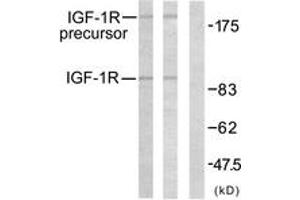 Western blot analysis of extracts from 293 cells, treated with Insulin, using IGF1R (Ab-1161) Antibody. (IGF1R Antikörper  (AA 1126-1175))