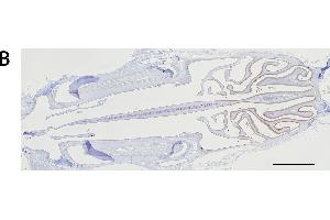 Immunohistochemistry analysis of the expression of the mu and alpha class GSTs. (GSTM4 Antikörper  (AA 21-215))