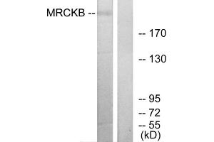 Western blot analysis of extracts from COLO cells, using MRCKB antibody. (CDC42BPB Antikörper  (C-Term))