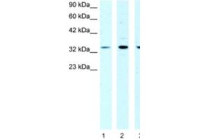Western Blotting (WB) image for anti-Cold Shock Domain Protein A (CSDA) antibody (ABIN2463852) (CSDA Antikörper)