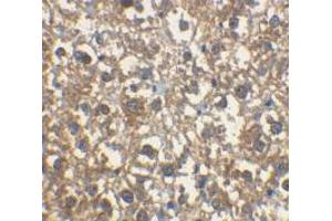 Immunohistochemical staining of rat liver cells using AP30443PU-N IRAK-M antibody at 2 μg/ml.