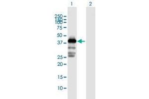 Western Blot analysis of MAGEA3 expression in transfected 293T cell line by MAGEA3 MaxPab polyclonal antibody. (MAGEA3 Antikörper  (AA 1-314))