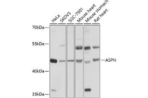 Western blot analysis of extracts of various cell lines, using ASPN antibody (ABIN6127375, ABIN6137217, ABIN6137218 and ABIN6214518) at 1:1000 dilution. (Asporin Antikörper  (AA 100-379))