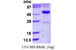 SDS-PAGE (SDS) image for Isocitrate Dehydrogenase 3 (NAD+) gamma (IDH3G) (AA 40-393) protein (His tag) (ABIN667990) (IDH3G Protein (AA 40-393) (His tag))