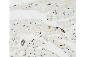 Immunohistochemistry of paraffin-embedded Rat heart using THAP1 Polyclonal Antibody at dilution of 1:100 (40x lens). (THAP1 Antikörper)