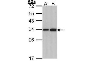 WB Image Sample (30 ug of whole cell lysate) A: Hep G2 , B: Molt-4 , 12% SDS PAGE antibody diluted at 1:1000 (RPL8 Antikörper)
