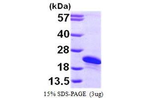 SDS-PAGE (SDS) image for ADP-Ribosylation Factor-Like 2 Binding Protein (ARL2BP) (AA 1-163) protein (His tag) (ABIN667251) (ARL2BP Protein (AA 1-163) (His tag))