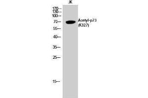 Western Blotting (WB) image for anti-Tumor Protein P73 (TP73) (acLys327) antibody (ABIN3181894)