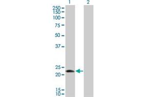 Western Blot analysis of LOC51136 expression in transfected 293T cell line by LOC51136 monoclonal antibody (M01), clone 4H7.