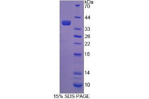 SDS-PAGE analysis of Human COASY Protein. (COASY Protein)