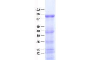 Validation with Western Blot