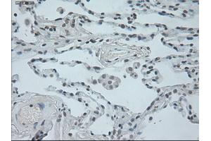 Immunohistochemical staining of paraffin-embedded lung tissue using anti-OSMmouse monoclonal antibody.