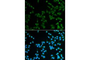 Immunofluorescence analysis of A549 cells using SPIN1 antibody (ABIN5973464). (Spindlin 1 Antikörper)
