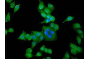 Immunofluorescence staining of Hela cells with ABIN7143823 at 1:133, counter-stained with DAPI. (ACTN3 Antikörper  (AA 497-667))