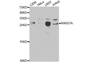 Western Blotting (WB) image for anti-RAB27A, Member RAS Oncogene Family (RAB27A) antibody (ABIN1874505) (RAB27A Antikörper)