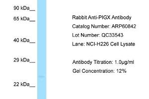 Western Blotting (WB) image for anti-Phosphatidylinositol Glycan Anchor Biosynthesis, Class X (PIGX) (C-Term) antibody (ABIN2788605)