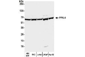 Western Blotting (WB) image for anti-Peptidylprolyl Isomerase (Cyclophilin)-Like 4 (PPIL4) (AA 375-425) antibody (ABIN7450591)