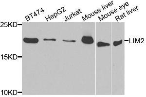 Western blot analysis of extracts of various cell lines, using LIM2 antibody. (LIM2 Antikörper  (AA 25-110))