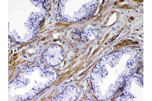 IHC analysis of VEGF Receptor 3 using anti-VEGF Receptor 3 antibody . (FLT4 Antikörper)