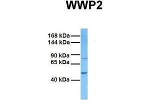 Host:  Rabbit  Target Name:  WWP2  Sample Tissue:  Human Fetal Liver  Antibody Dilution:  1. (WWP2 Antikörper  (Middle Region))