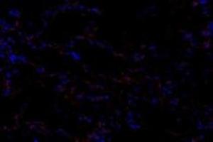 Immunofluorescent analysis of paraformaldehyde-fixed human lung using,GNE (ABIN7074056) at dilution of 1: 600 (GNE Antikörper)