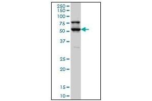 Western Blotting (WB) image for anti-serine/threonine Kinase 17a (STK17A) (AA 301-414) antibody (ABIN614691) (STK17A Antikörper  (AA 301-414))