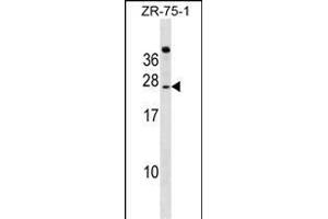 IGSF6 Antibody (Center) (ABIN1538572 and ABIN2849263) western blot analysis in ZR-75-1 cell line lysates (35 μg/lane). (IGSF6 Antikörper  (AA 69-97))