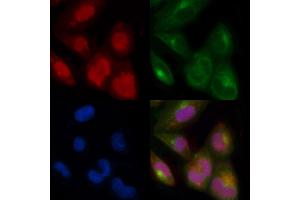 ABIN7093813 and ABIN7097856 staining  cells by IF/ICC.