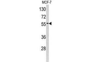 Image no. 1 for anti-Epsin 3 (EPN3) (N-Term) antibody (ABIN452971) (EPN3 Antikörper  (N-Term))