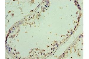Immunohistochemistry of paraffin-embedded human testis tissue using ABIN7143999 at dilution of 1:100 (AIMP2 Antikörper  (AA 141-320))