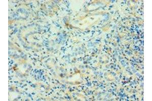 Immunohistochemistry of paraffin-embedded human kidney tissue using ABIN7144130 at dilution of 1:100 (AGT Antikörper  (AA 35-285))