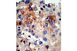 Image no. 3 for anti-Histone Deacetylase 9 (HDAC9) (N-Term) antibody (ABIN356655) (HDAC9 Antikörper  (N-Term))