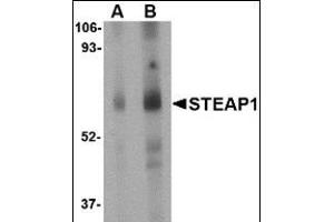 Western blot analysis of STEAP1 in human spleen tissue lysate with this product at (A) 1 and (B) 2 μg/ml. (STEAP1 Antikörper  (Center))