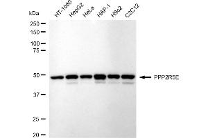 Western blotting analysis using PPP2R5E antibody (ABIN7800024).