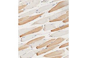 Immunohistochemical analysis of paraffin-embedded human skeletal muscle tissue using (ABIN6244160 and ABIN6578849) performed on the Leica® BOND RXm.