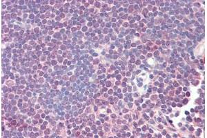 Human Thymus (formalin-fixed, paraffin-embedded) stained with ZAP70 antibody ABIN461961 at 20 ug/ml followed by biotinylated anti-mouse IgG secondary antibody ABIN481714, alkaline phosphatase-streptavidin and chromogen. (ZAP70 Antikörper)
