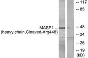 Western blot analysis of extracts from A549 cells, treated with etoposide 25uM 24h, using MASP1 (heavy chain,Cleaved-Arg448) Antibody. (MASP1 Antikörper  (Cleaved-Arg448))