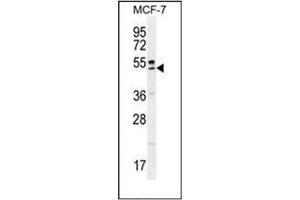 Western blot analysis of QTRTD1 Antibody (C-term) in MCF-7 cell line lysates (35ug/lane). (QTRTD1 Antikörper  (C-Term))