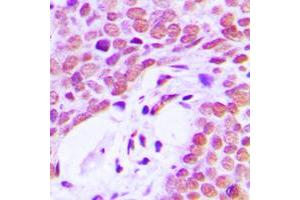 Immunohistochemistry (IHC) image for anti-X-Ray Repair Complementing Defective Repair in Chinese Hamster Cells 5 (Double-Strand-Break Rejoining) (XRCC5) (C-Term) antibody (ABIN7297292)