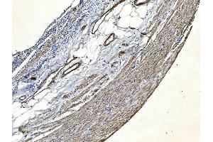 IHC analysis of Filamin A/FLNA using anti-Filamin A/FLNA antibody (ABIN7601783).