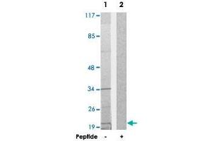 Western blot analysis of extracts from HepG2 cells, using TAF9 polyclonal antibody . (TAF9 Antikörper)