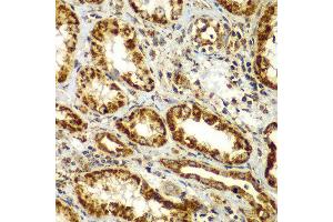 Immunohistochemistry of paraffin-embedded human kidney using SMAD9 antibody at dilution of 1:100 (x400 lens). (SMAD9 Antikörper)