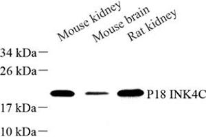Western blot analysis of P18 INK4C (ABIN7073645) at dilution of 1: 500 (CDKN2C Antikörper)
