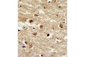 Immunohistochemistry (Paraffin-embedded Sections) (IHC (p)) image for anti-Insulin-Like Growth Factor Binding Protein 2, 36kDa (IGFBP2) (AA 277-305), (C-Term) antibody (ABIN652528)