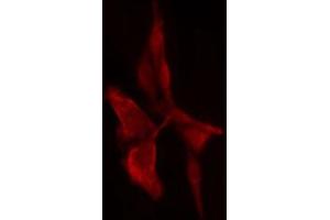 ABIN6274714 staining 293 cells by IF/ICC. (PSMD11 Antikörper  (Internal Region))