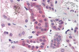 Human Kidney (formalin-fixed, paraffin-embedded) stained with RPAIN antibody ABIN214468 at 5 ug/ml followed by biotinylated goat anti-rabbit IgG secondary antibody ABIN481713, alkaline phosphatase-streptavidin and chromogen. (RPAIN Antikörper  (C-Term))