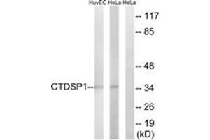 Western blot analysis of extracts from HeLa/HuvEc cells, using CTDSP1 Antibody. (CTDSP1 Antikörper  (AA 1-50))