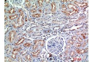 Immunohistochemistry (IHC) analysis of paraffin-embedded Human Kidney, antibody was diluted at 1:200. (CD56 Antikörper)