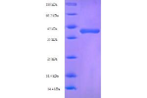 SDS-PAGE (SDS) image for Glutathione S-Transferase alpha 1 (GSTA1) (AA 2-222) protein (His-SUMO Tag) (ABIN5709615) (GSTA1 Protein (AA 2-222) (His-SUMO Tag))