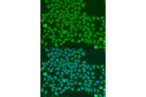 Immunofluorescence analysis of U2OS cells using TARDBP antibody. (TARDBP Antikörper  (AA 1-100))